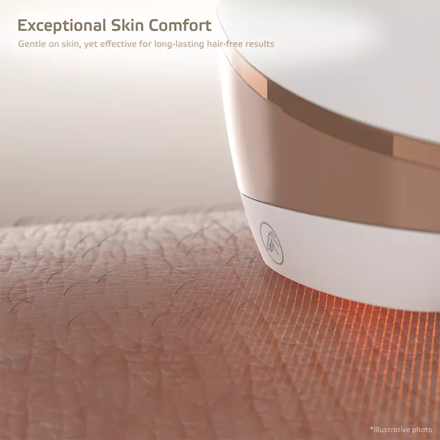 Фотоепилатор inSPORTline Aphira, 990 000 импулса