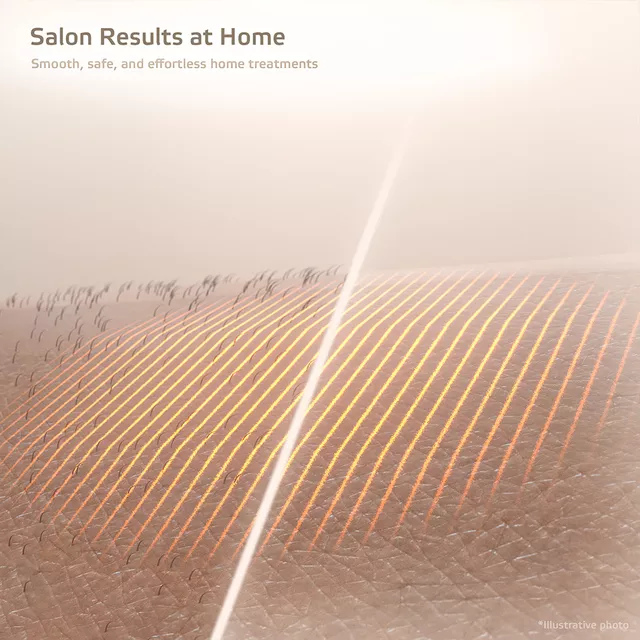 Фотоепилатор inSPORTline Aphira, 990 000 импулса