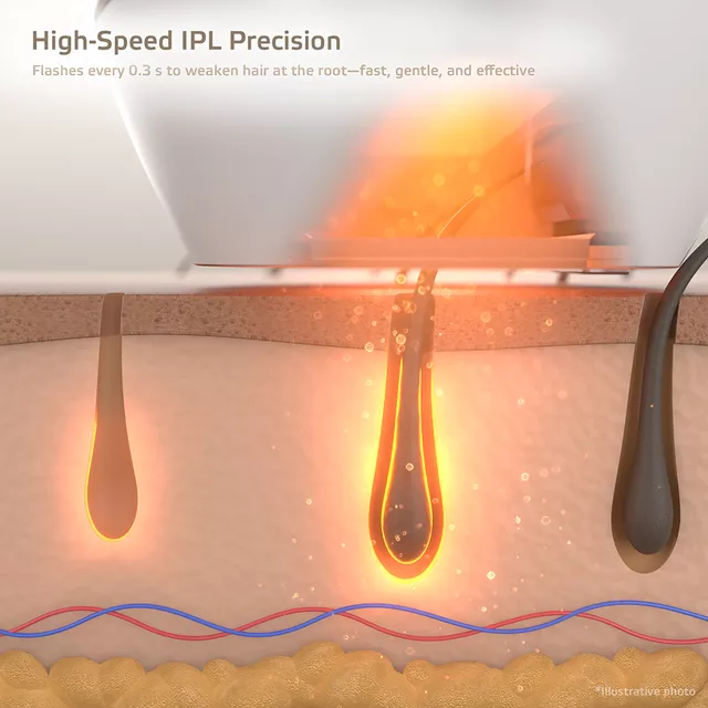 Фотоепилатор inSPORTline Aphira, 990 000 импулса