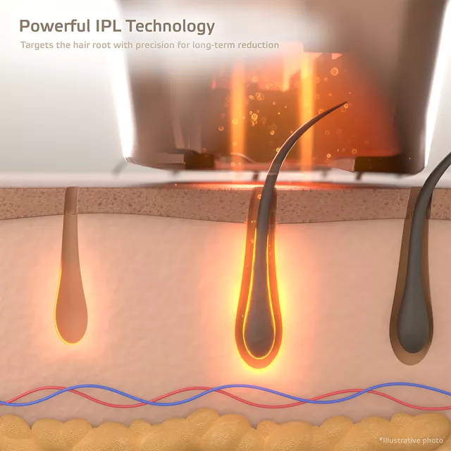 Фотоепилатор inSPORTline Eriva, 400 000 импулса